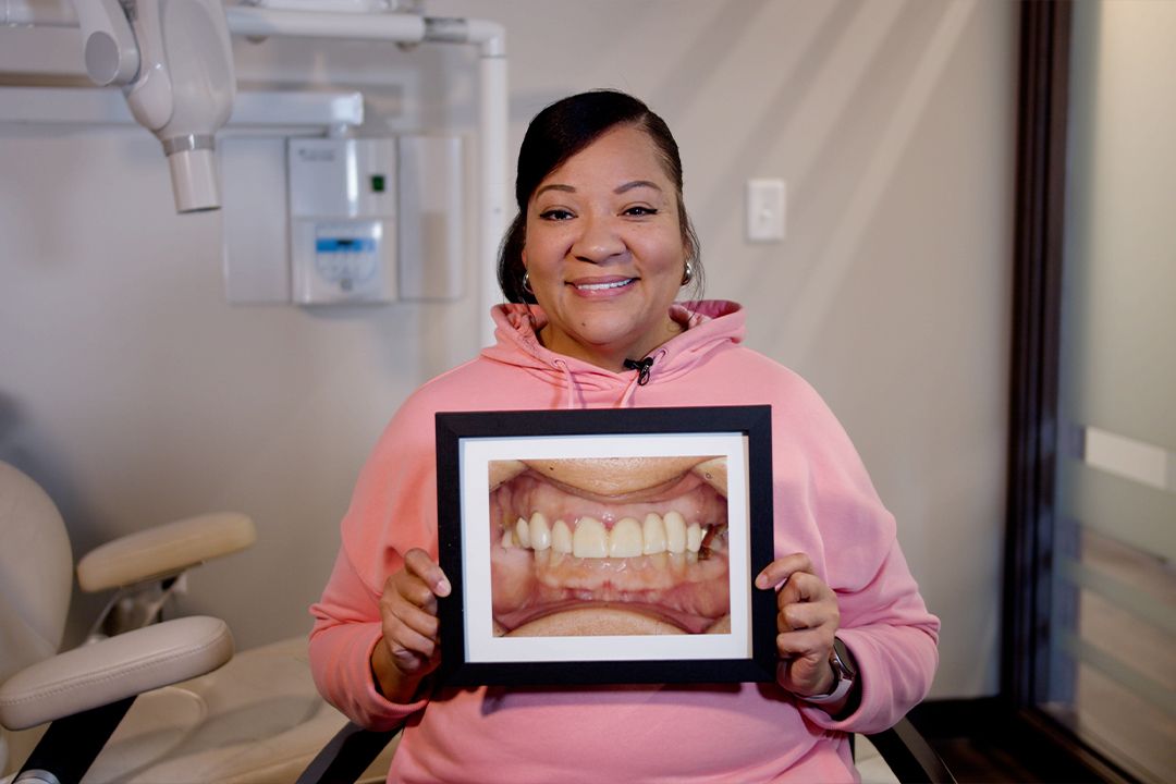 Theresa's Dental Implants transformation