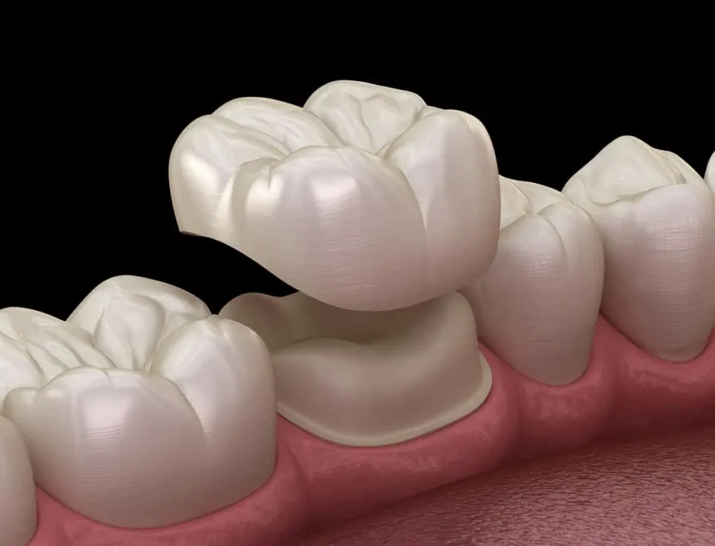 Comprehensive General Dentistry in Kansas City, KS
