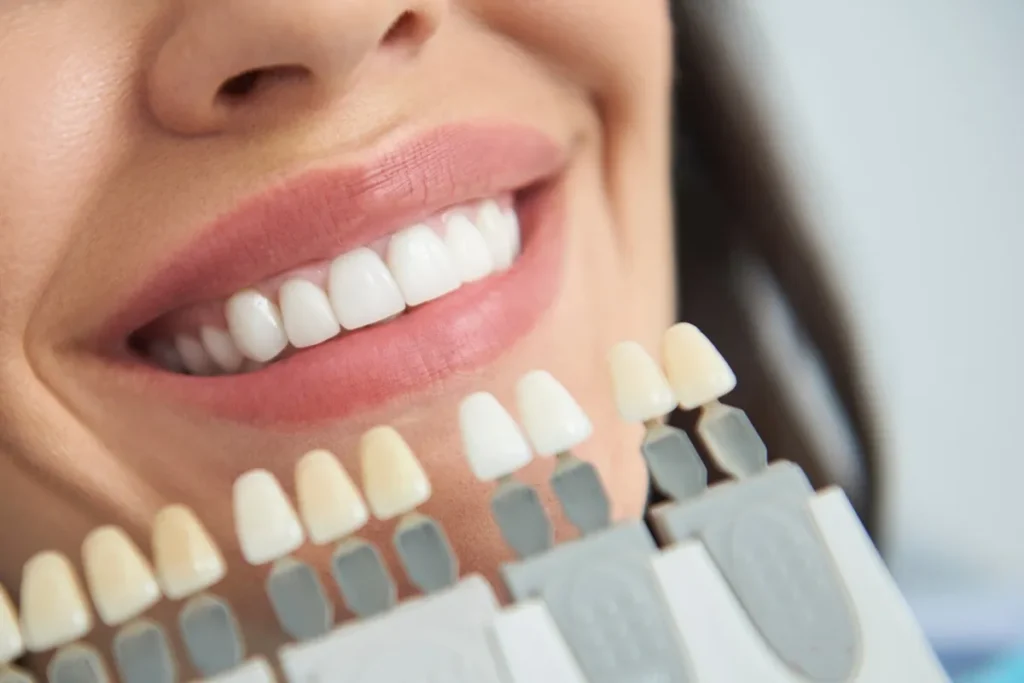 Full-Mouth Crowns in Kansas City at Gordon Dental Implants and Cosmetics