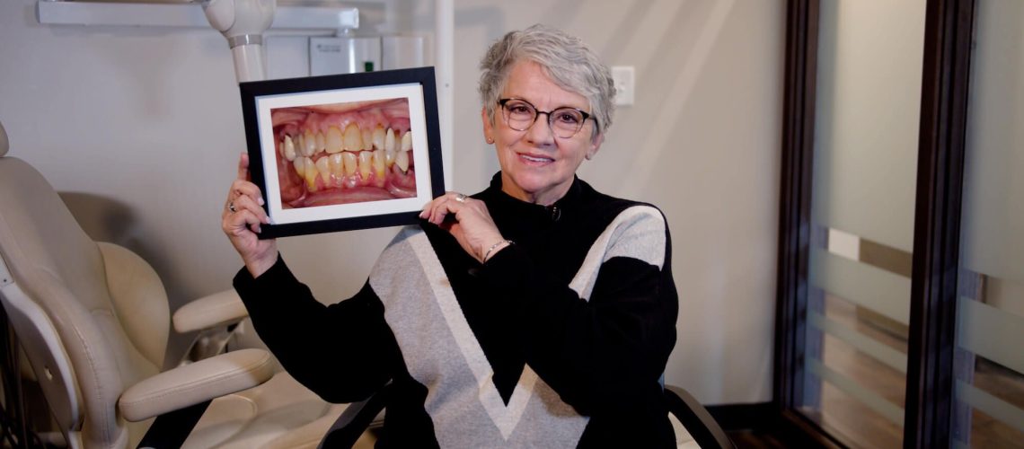 Peg's Dental Implants Transformation