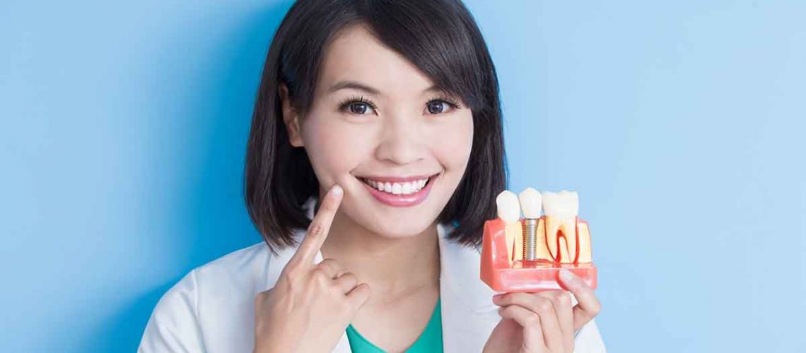 Dental Implant questions answered