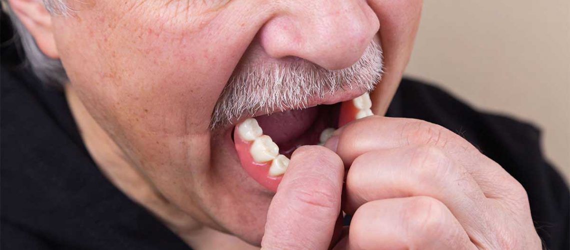 loose-dentures